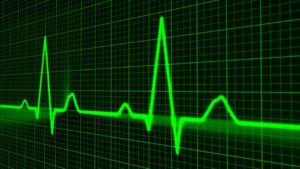 Puls EKG Hearth rate